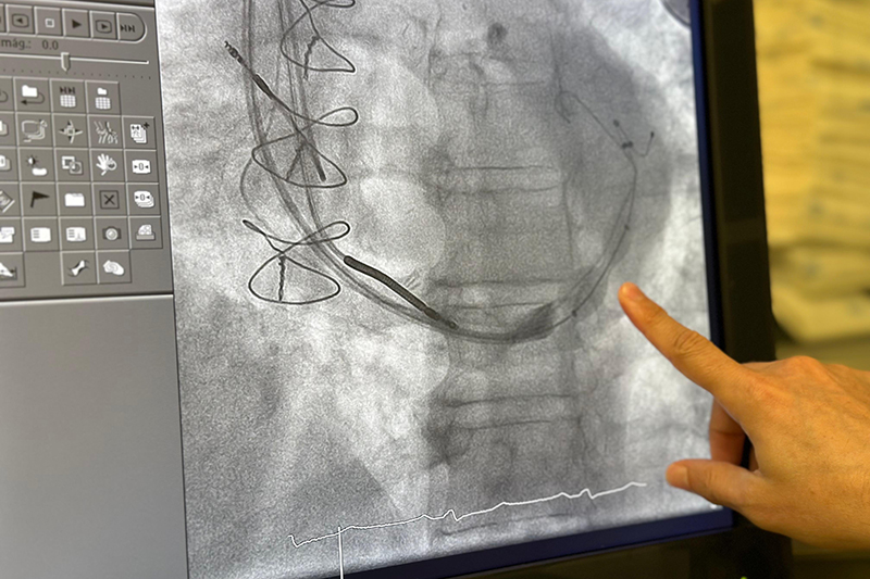detalle reducer